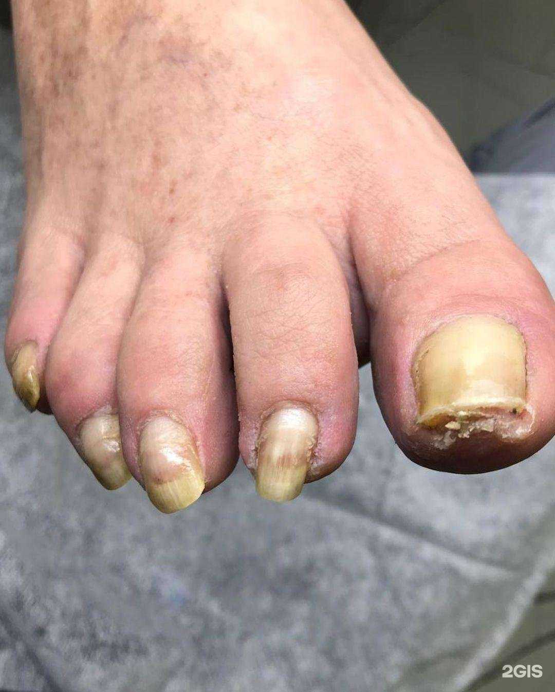 Отзывы на компанию Nxfeet в Коломне c фото