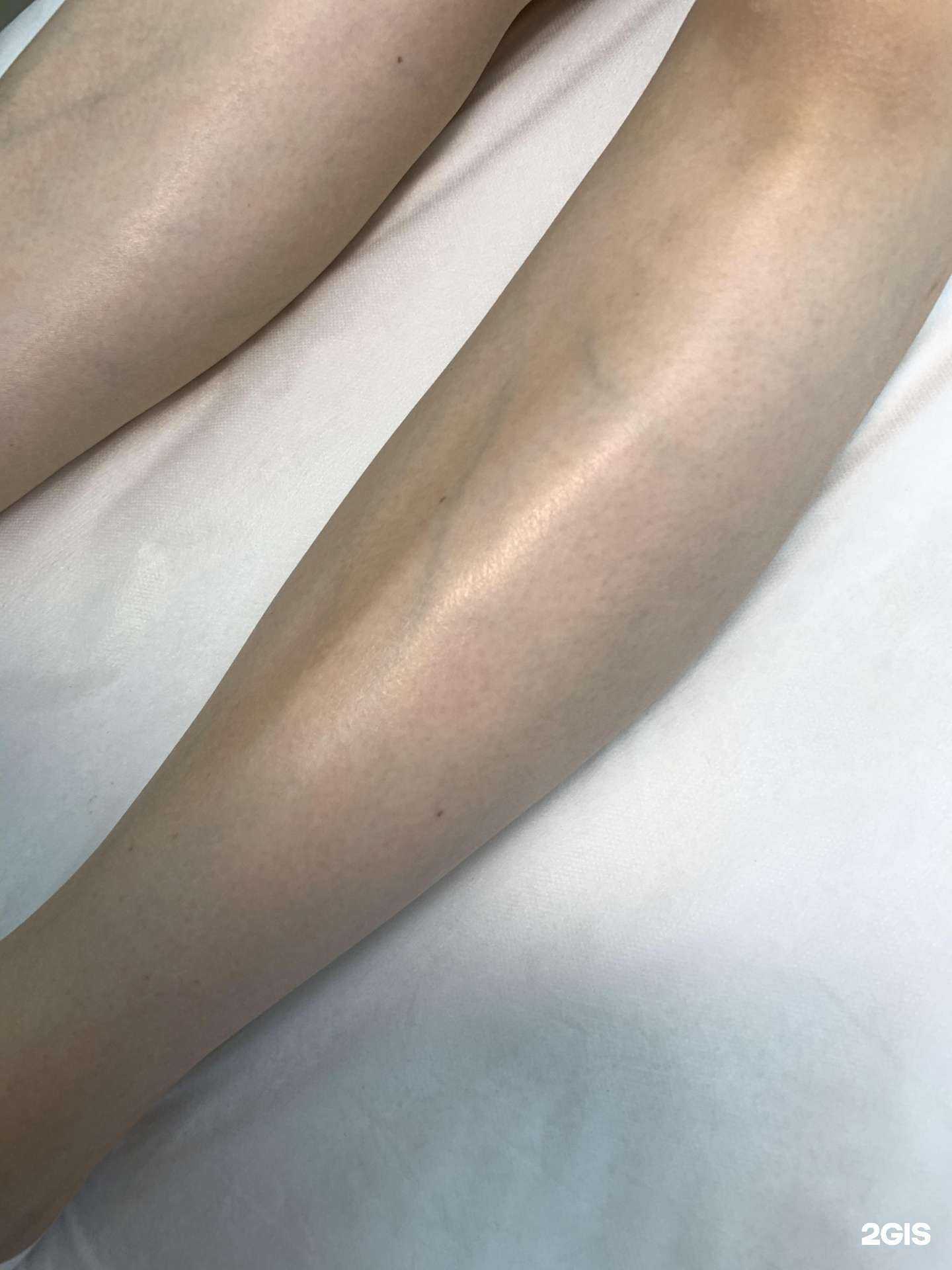 Отзывы на компанию laser room в Казани c фото