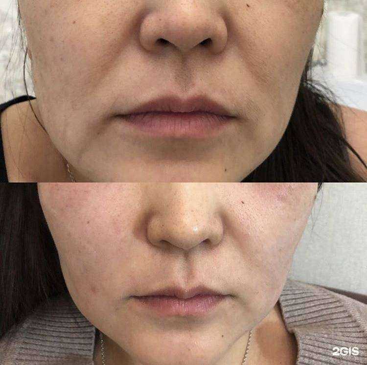 Отзывы на компанию Evolution Леся в Астрахани c фото