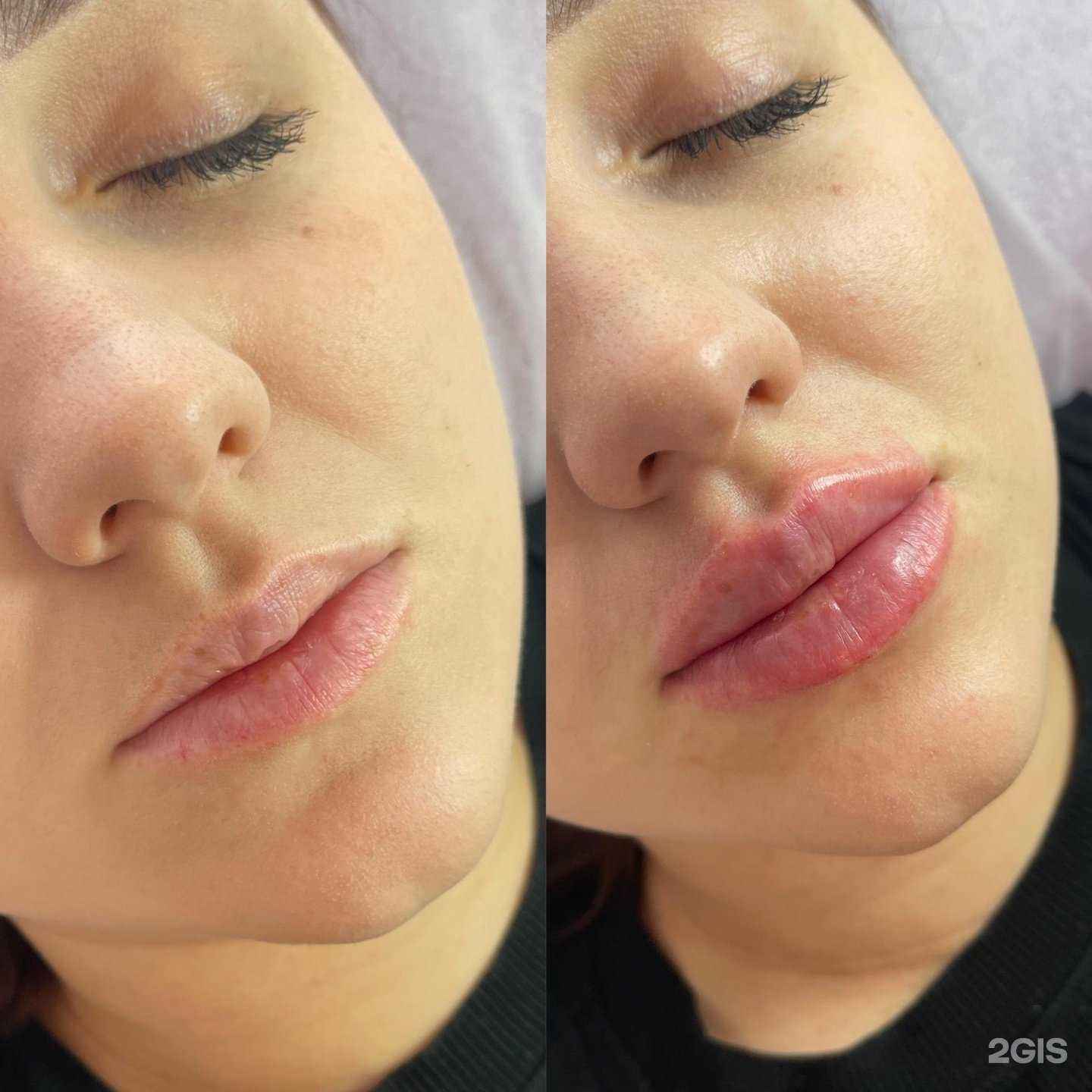 Отзывы на компанию Студия косметологии и эпиляции Бардовской Ксении в г. Владивосток c фото