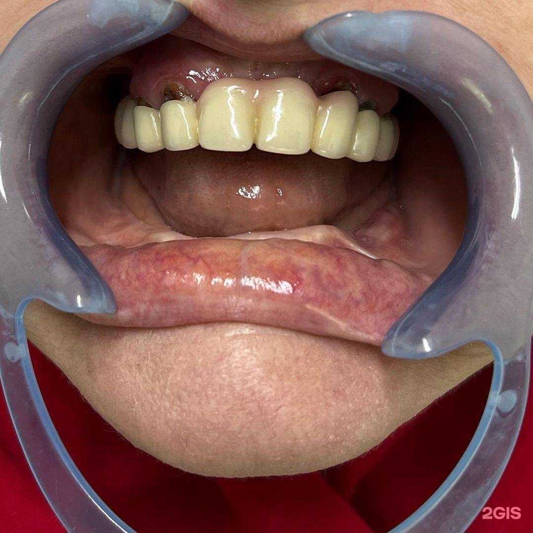 Отзывы на компанию Бехо в г. Грозный c фото