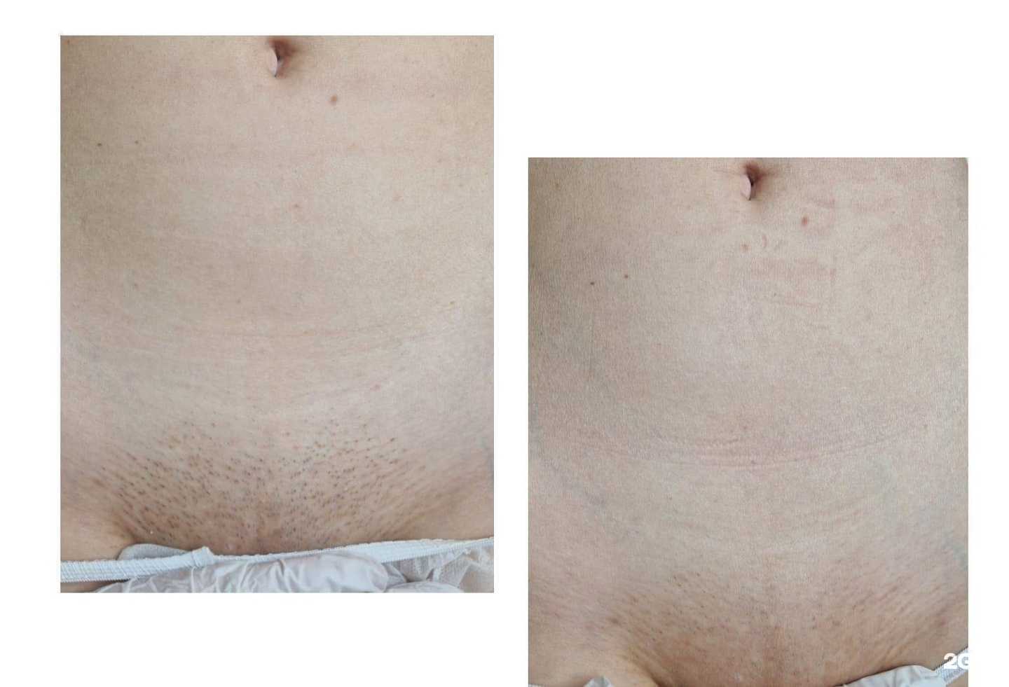 Отзывы на компанию Lazer V в Тамбове c фото