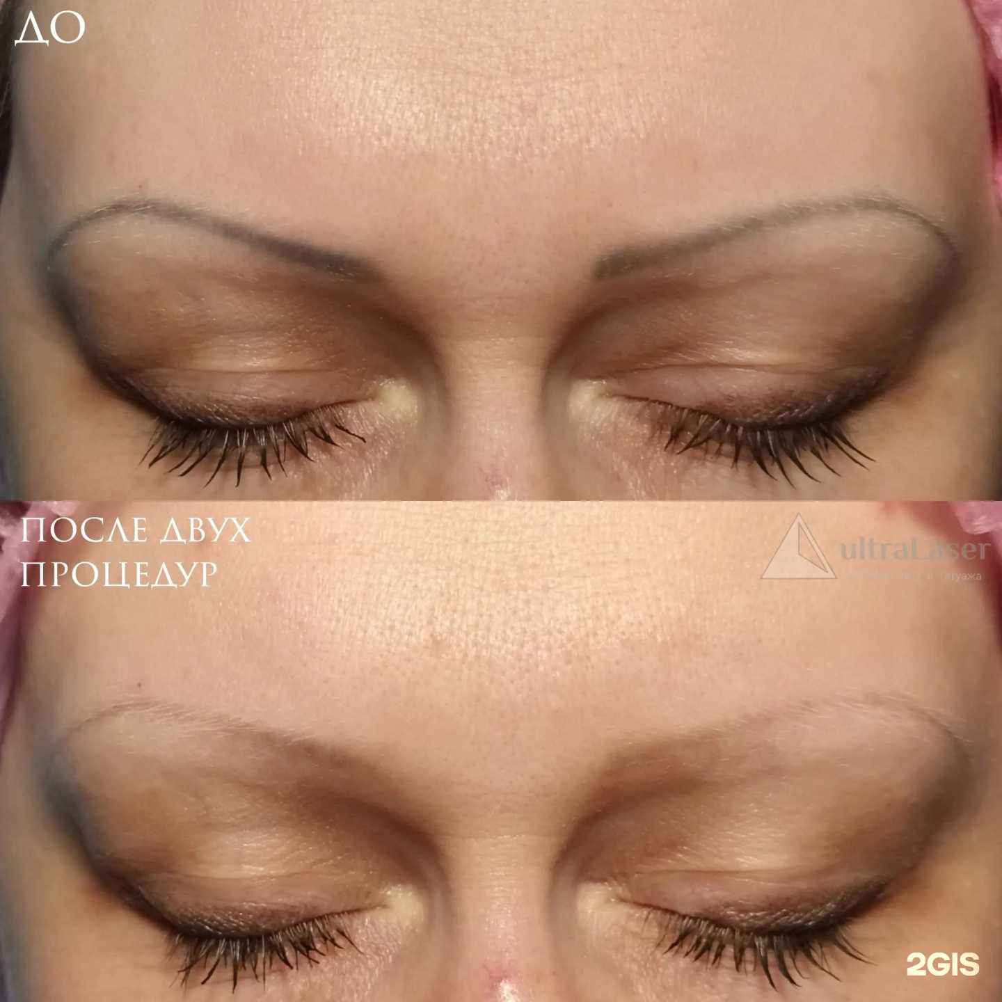 Отзывы на компанию UltraLaser в Тольятти c фото