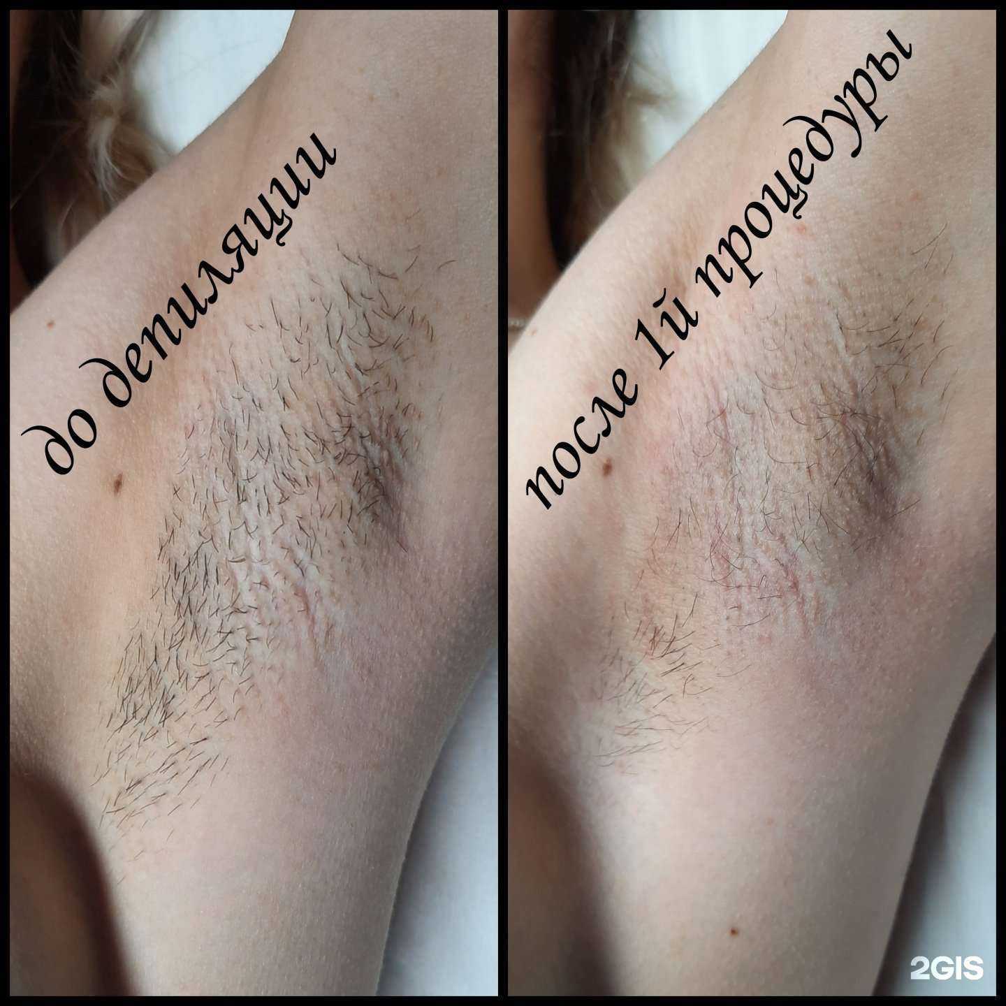 Отзывы на компанию Niсe_skin в Краснодаре c фото