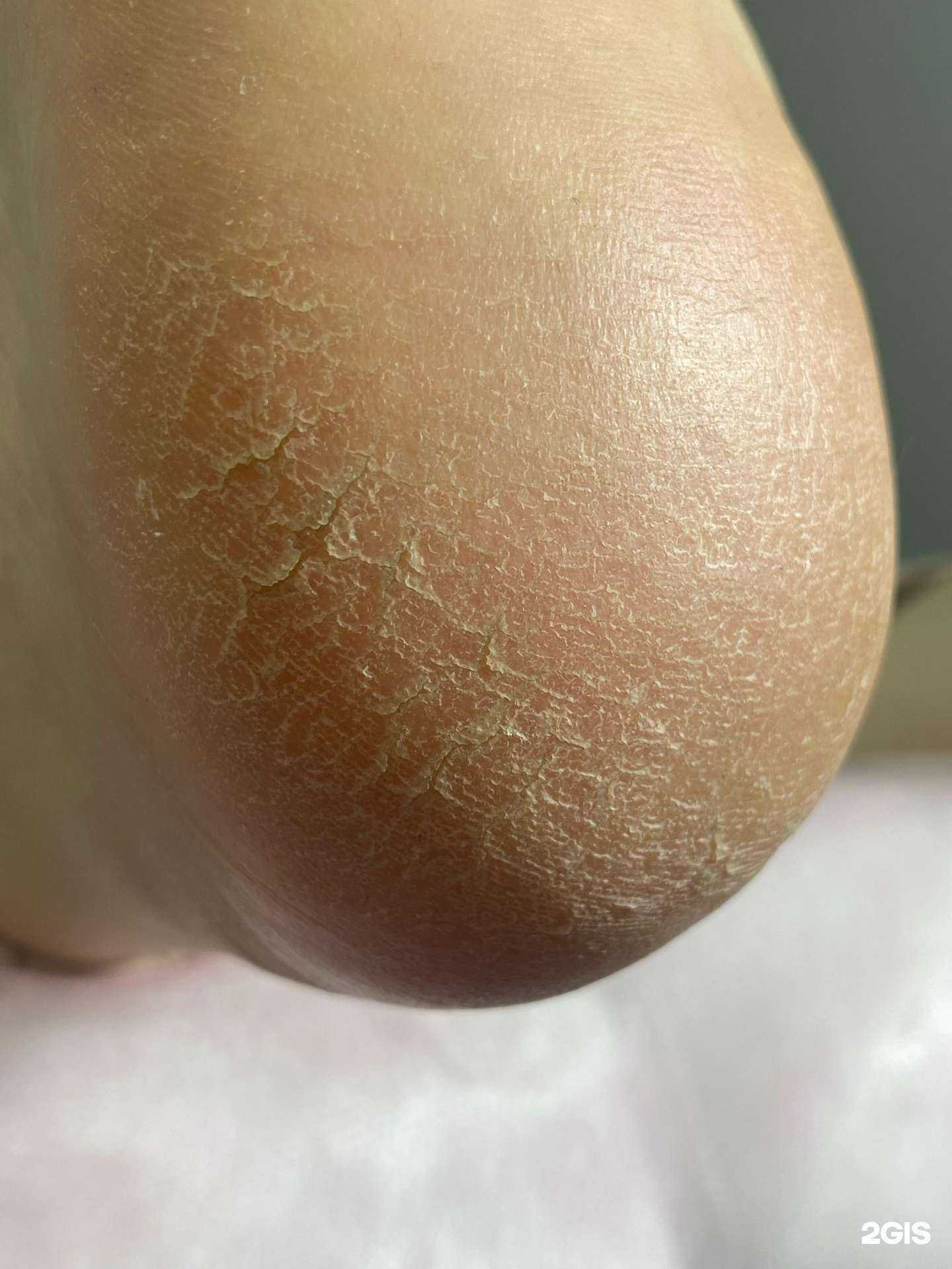 Отзывы на компанию Kuvshinka_nails studio  в Шуи c фото