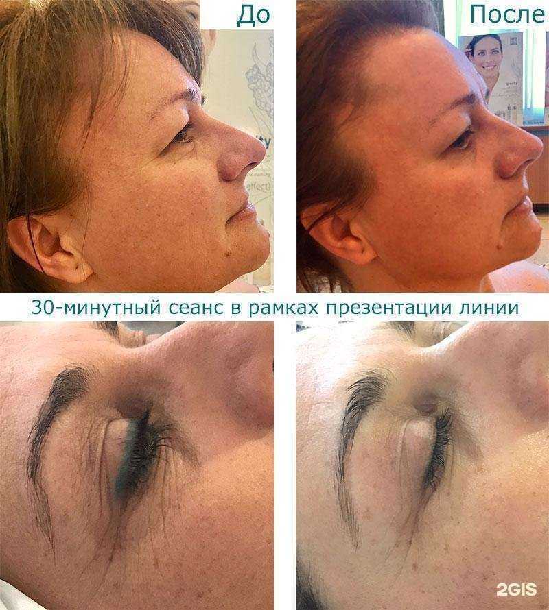 Отзывы на компанию Бельнатур в г. Новокузнецк c фото