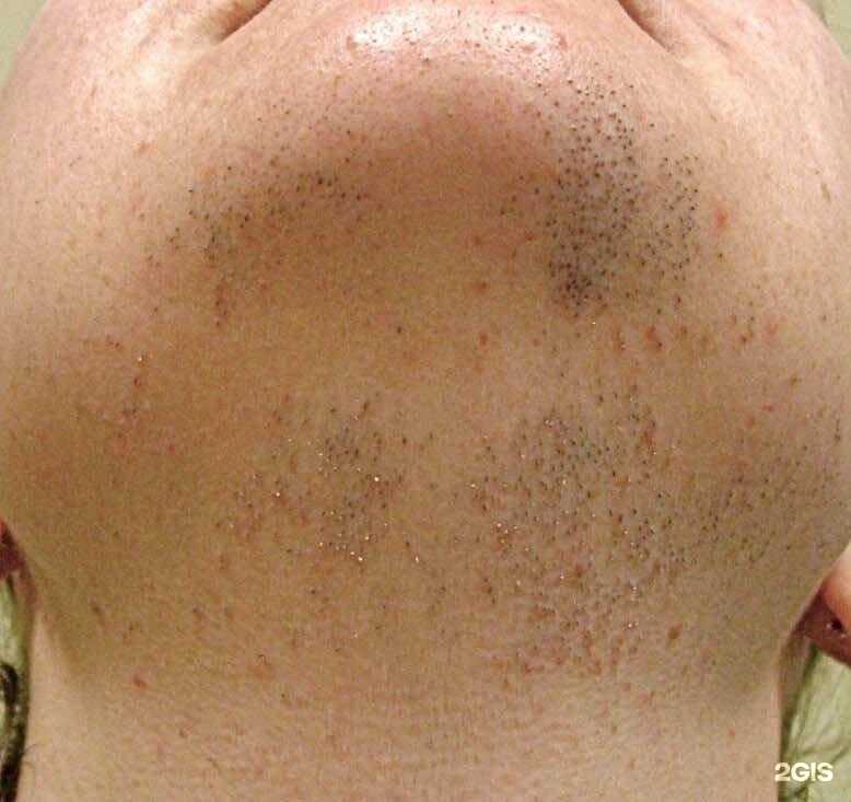 Отзывы на компанию Студия депиляции и пилинга в Сочи c фото