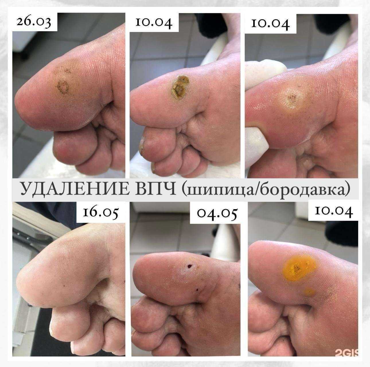 Отзывы на компанию Кабинет подолога в Новокузнецке c фото