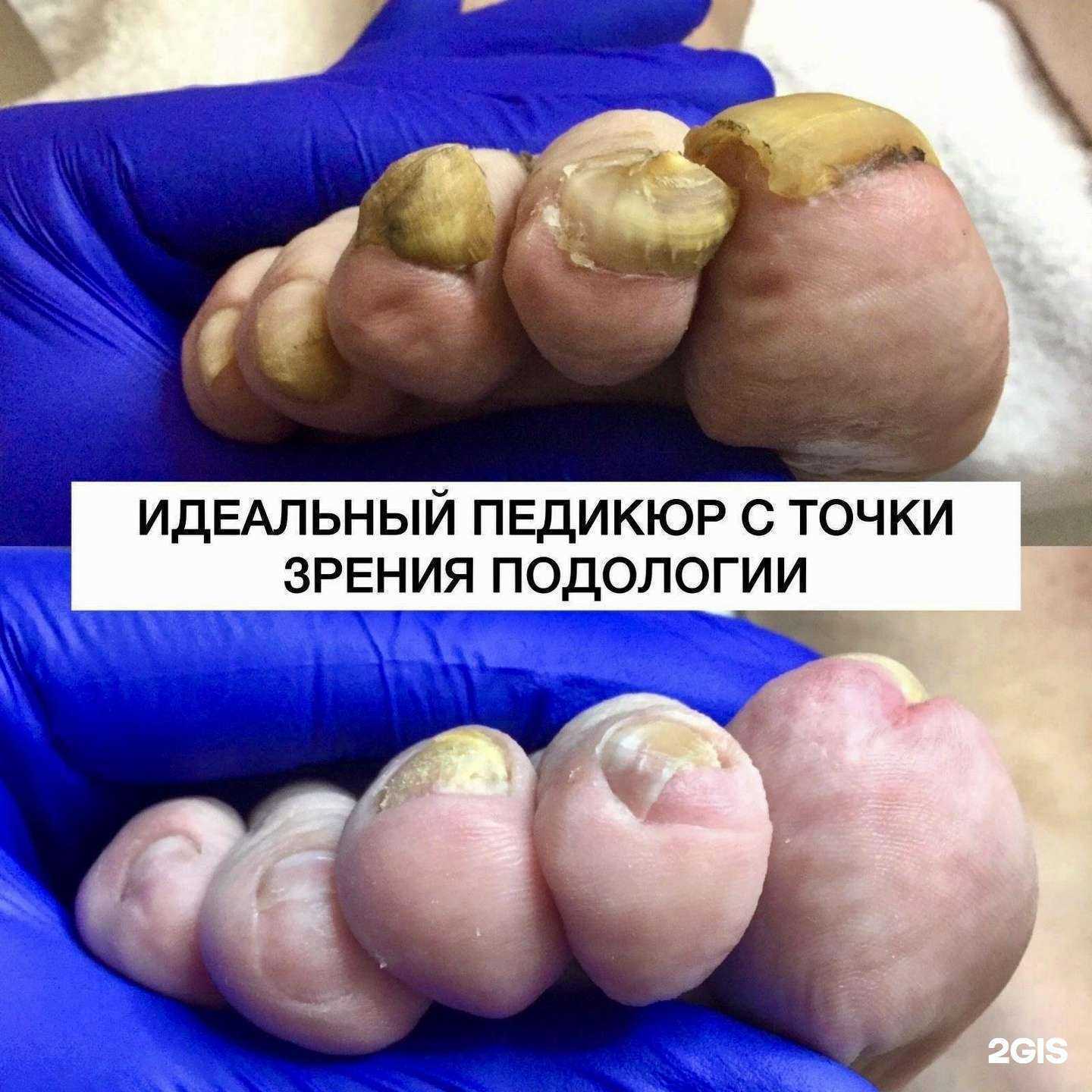 Отзывы на компанию Love pedicure в Иркутске c фото