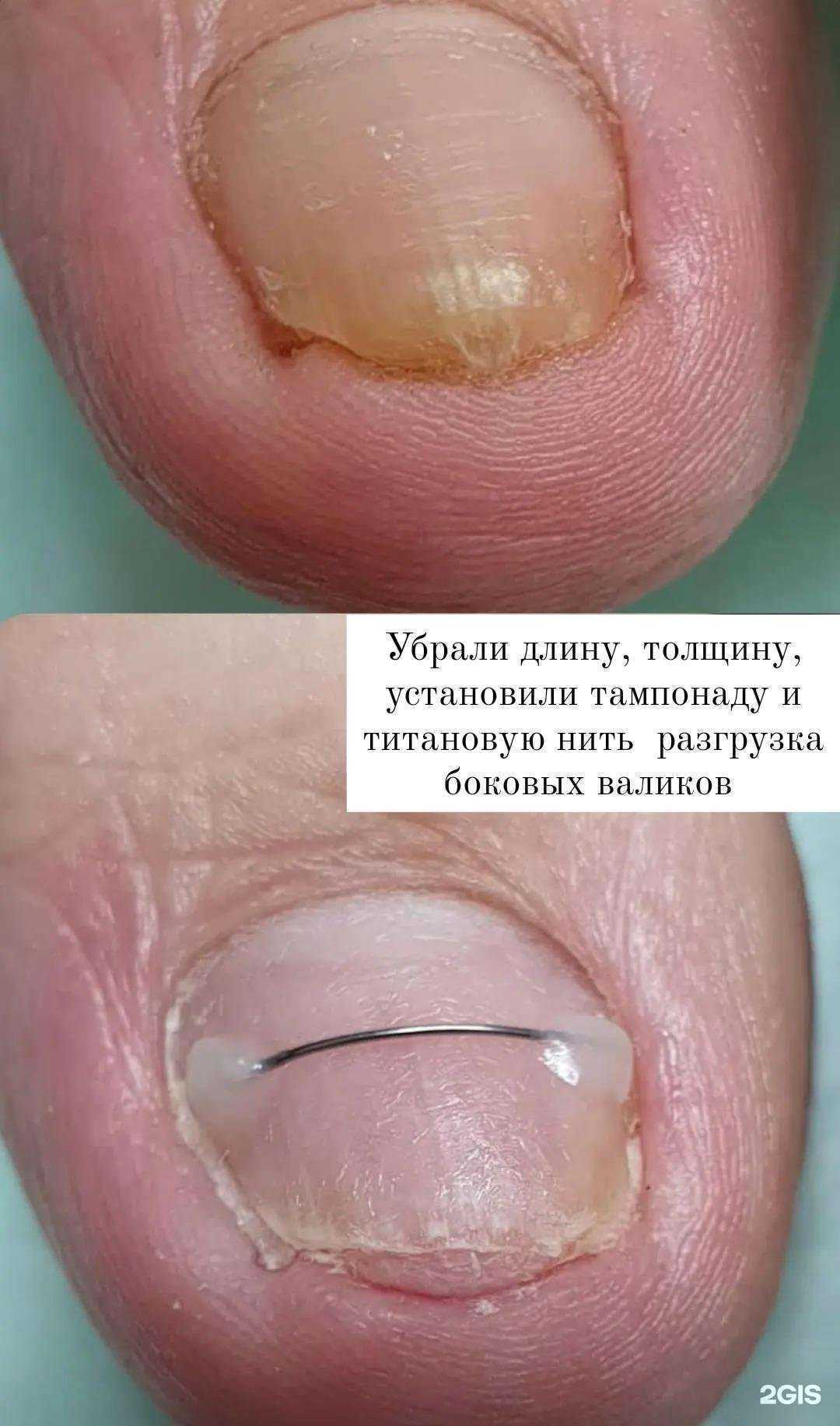 Отзывы на компанию Кабинет здоровой стопы и маникюра в Тюмени c фото