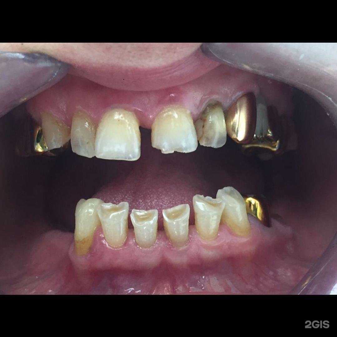 Отзывы на компанию Master Dent в Грозном c фото