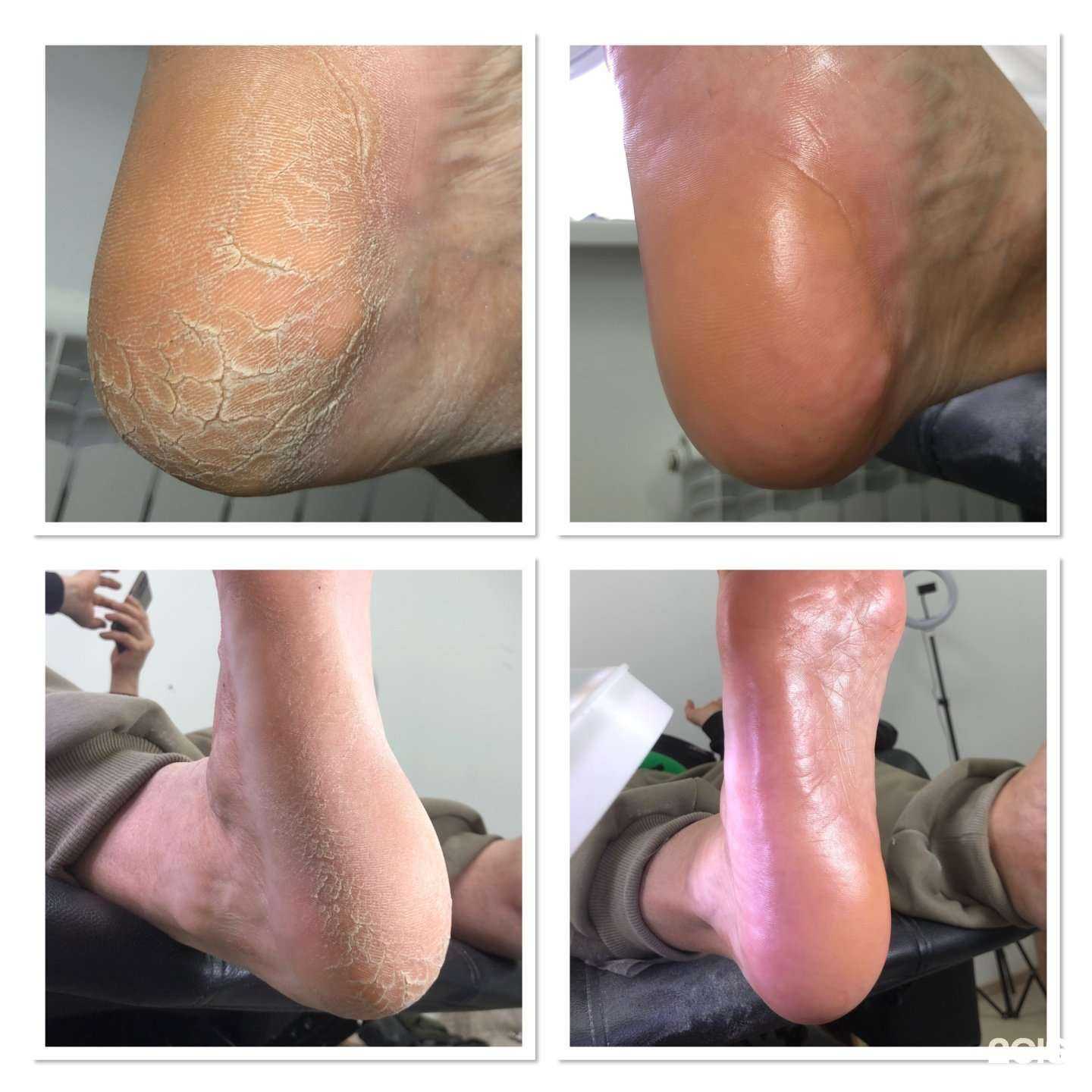 Отзывы на компанию Ваш подолог Бирюкова в Уссурийске c фото