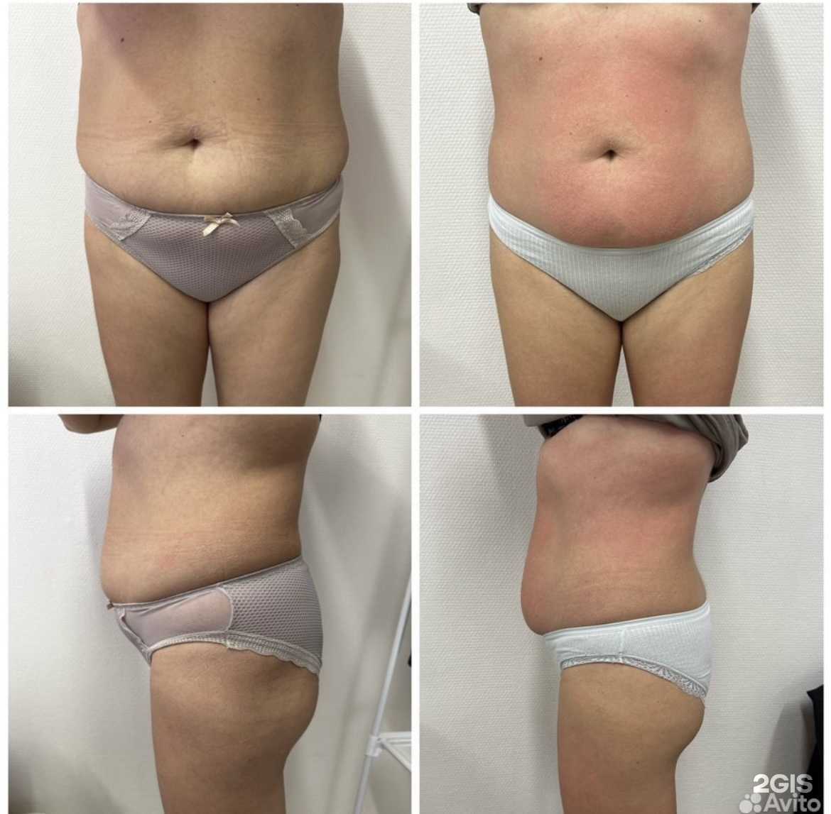 Отзывы на компанию A.N.I.B.E.A.U.T.Y в Уфе c фото