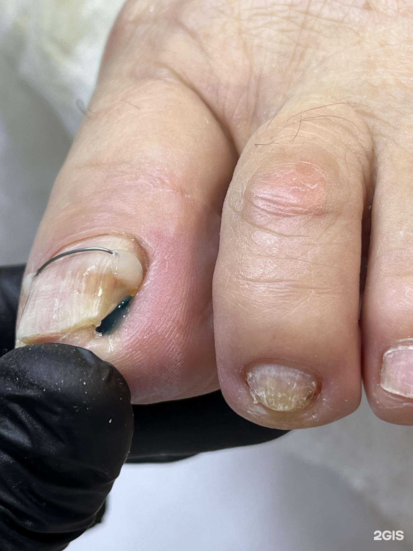 Отзывы на компанию Кабинет педикюра и подологии в Иркутске c фото