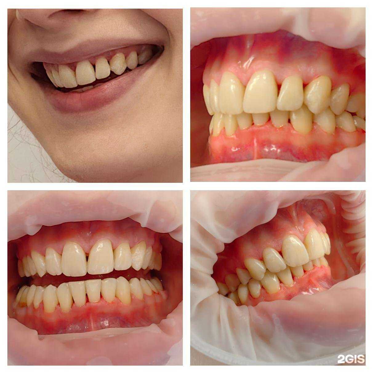 Отзывы на компанию Центр дентальной хирургии в Воронеже c фото