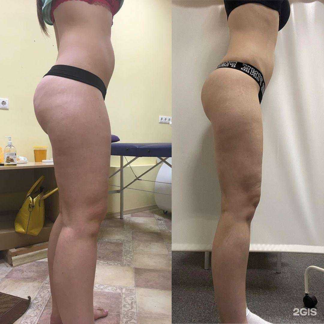 Отзывы на компанию Идеал в Ростове-на-Дону c фото