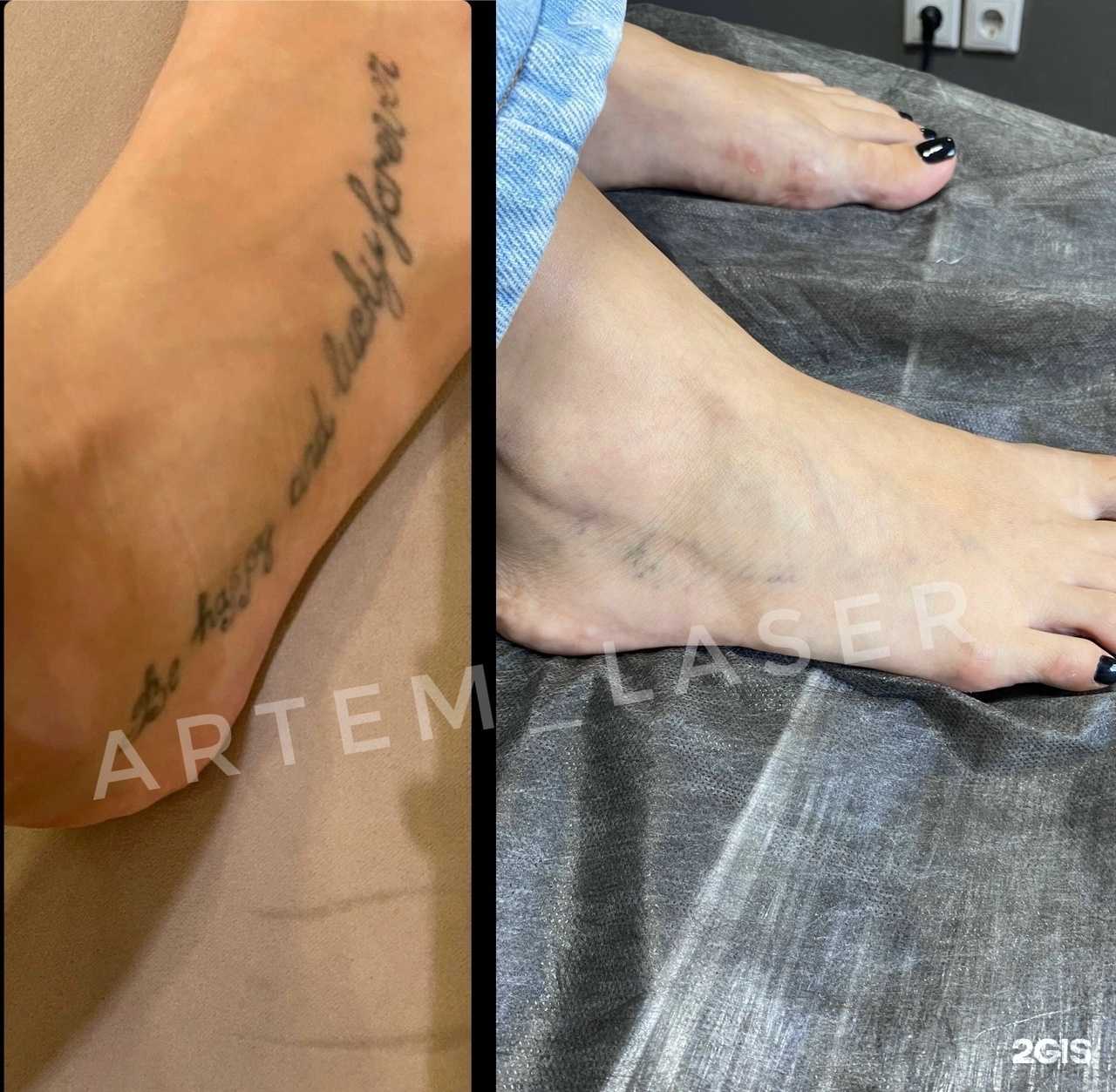 Отзывы на компанию Artem Laser в г. Барнаул c фото