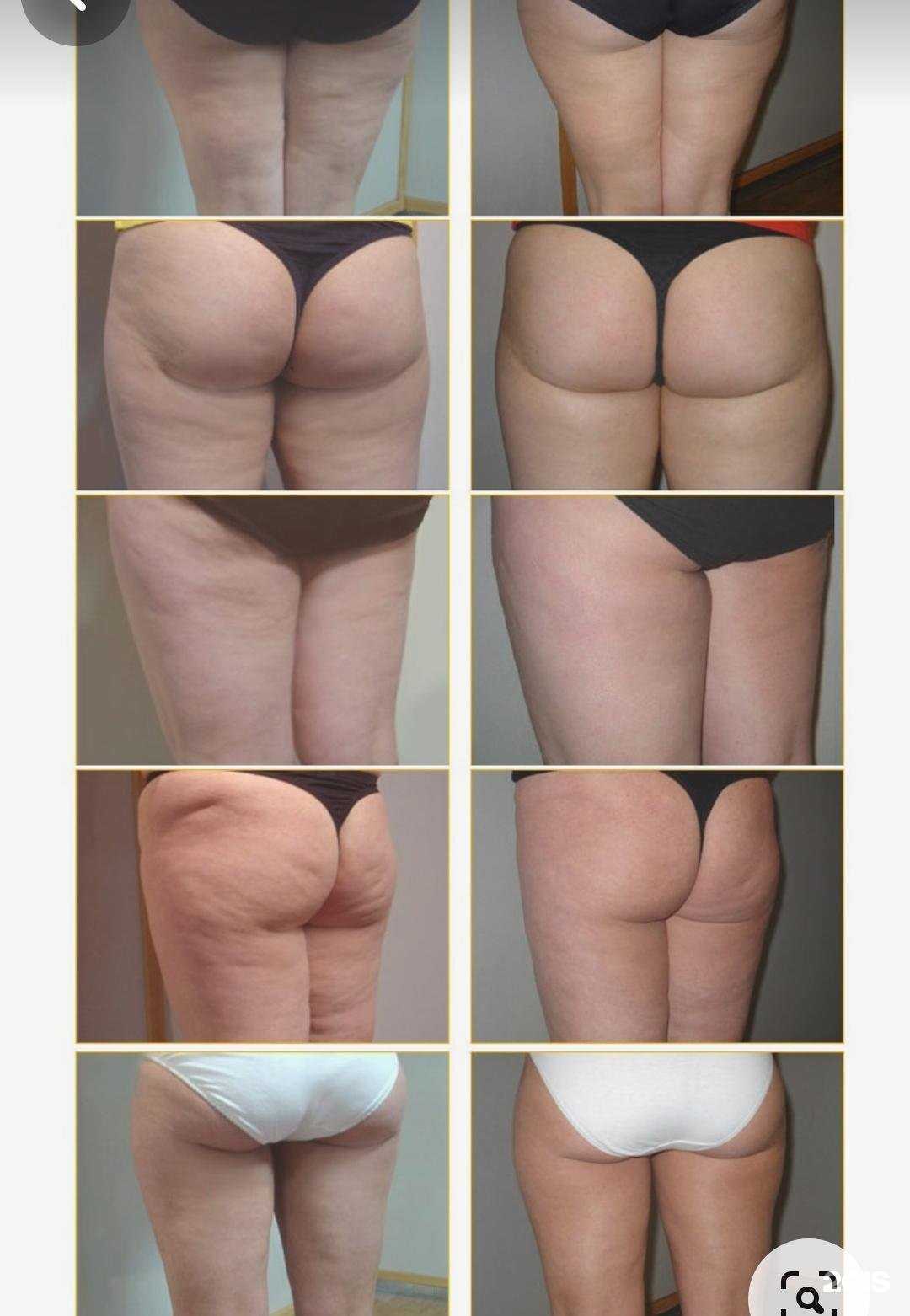 Отзывы на компанию Бодрость! в г. Геленджик c фото