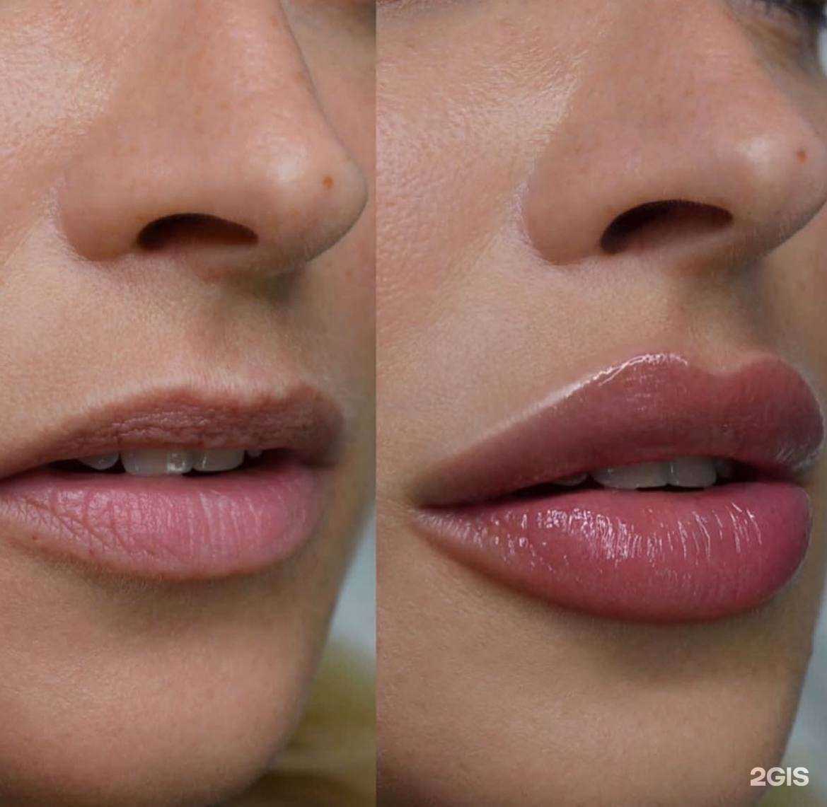 Отзывы на компанию Кабинет косметолога в Анапе c фото