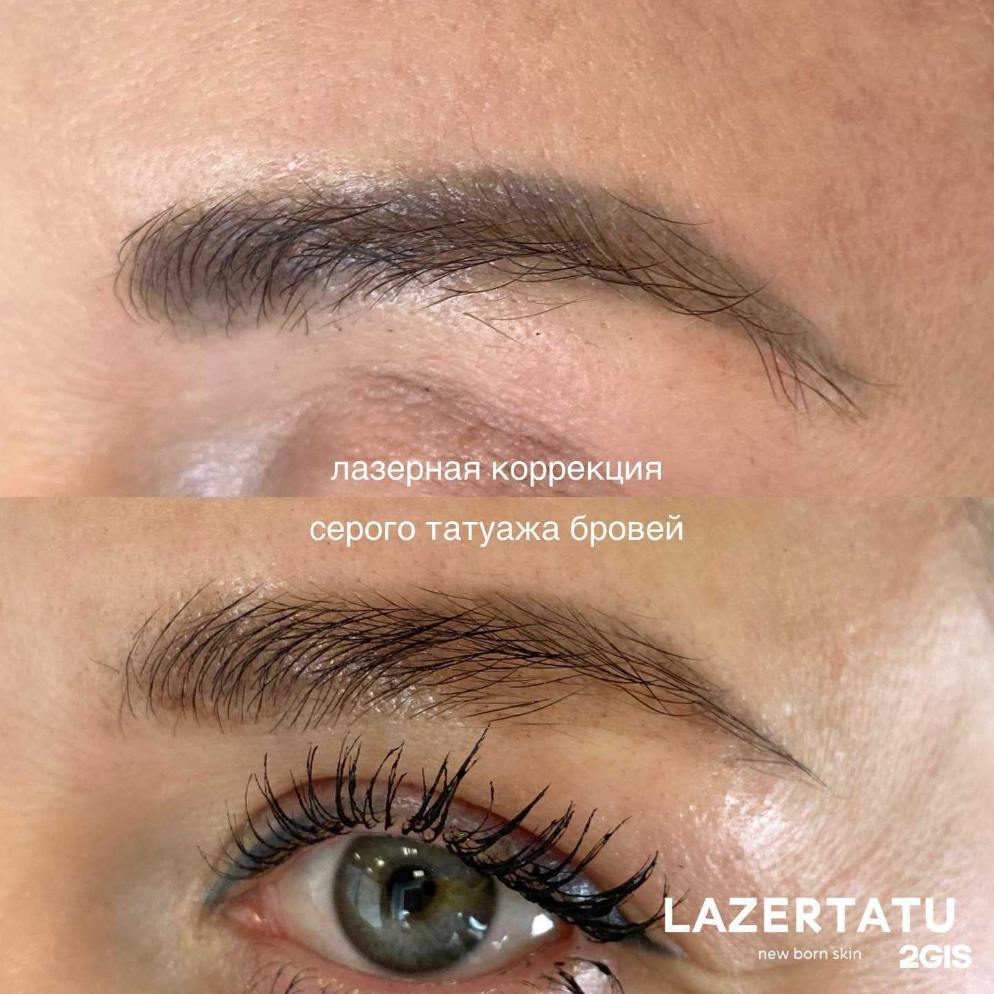 Отзывы на компанию Lazertatu в г. Норильск c фото