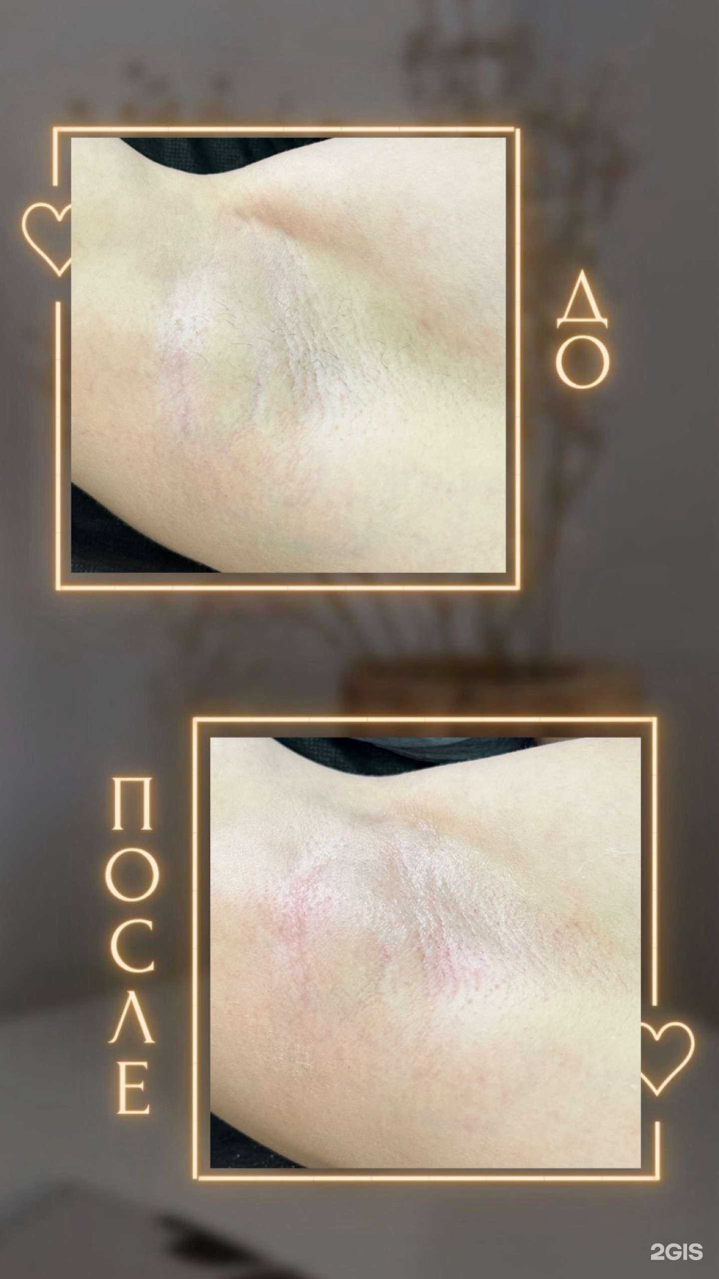 Отзывы на компанию Студия депиляции Валерии Шафрик  в Омске c фото