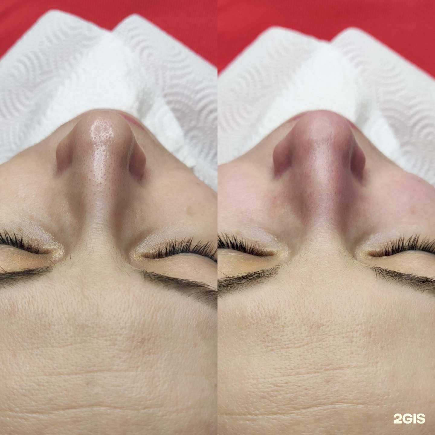 Отзывы на компанию Face Lifting Studio в Казани c фото