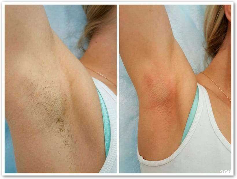 Отзывы на компанию BRAVO в г. Орёл c фото