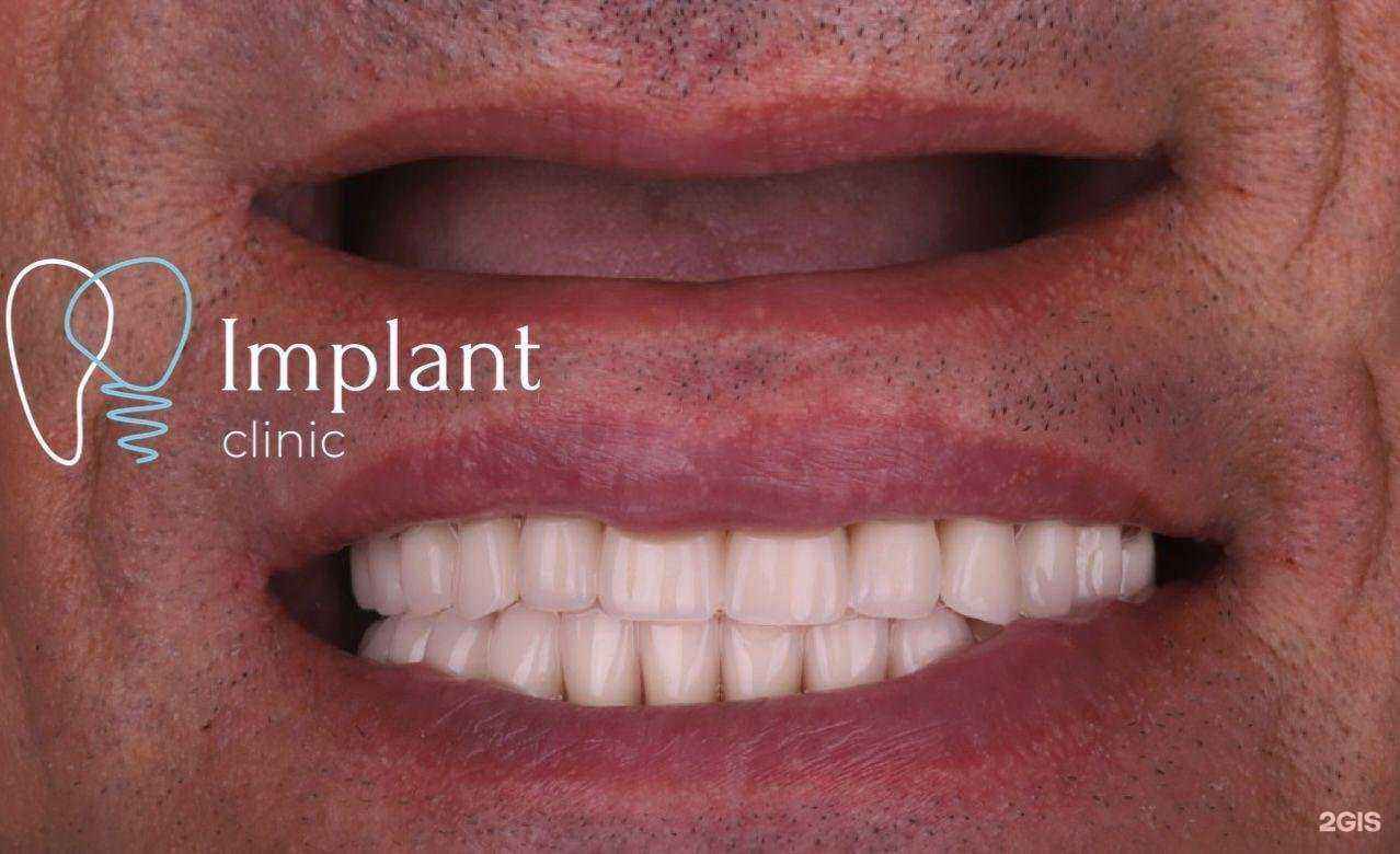 Отзывы на компанию Implant Clinic в г. Краснодар c фото
