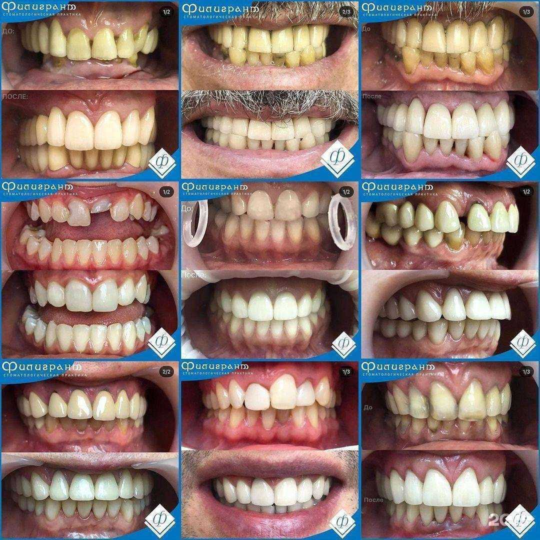 Отзывы на компанию Филигрант в г. Майкоп c фото