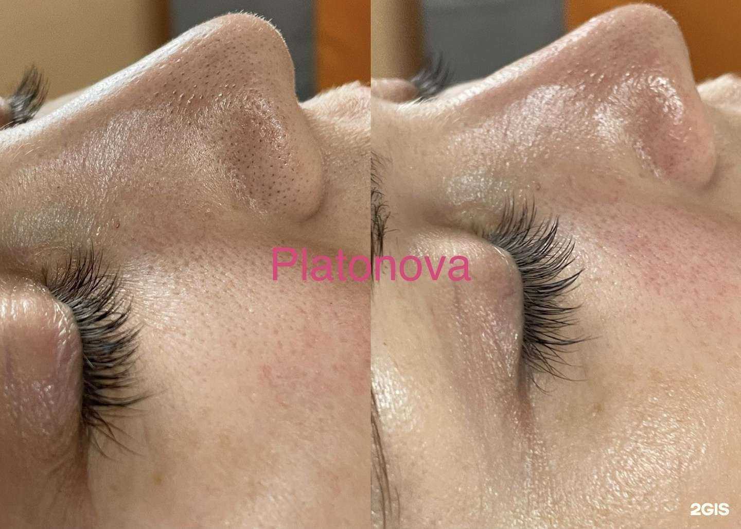 Отзывы на компанию Кабинет косметолога в Нижнем Новгороде c фото