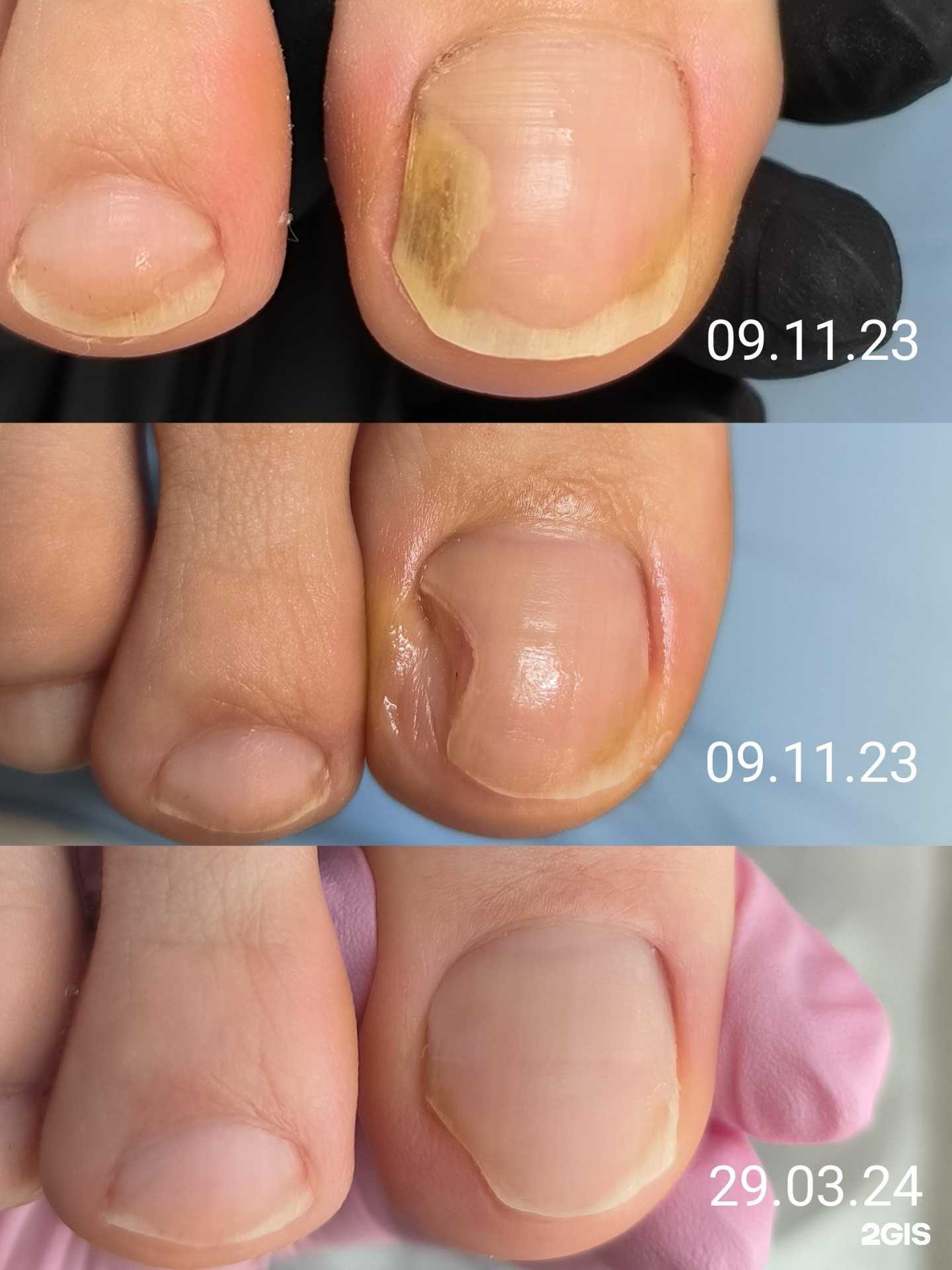 Отзывы на компанию Кабинет подологии и эстетики в Перми c фото