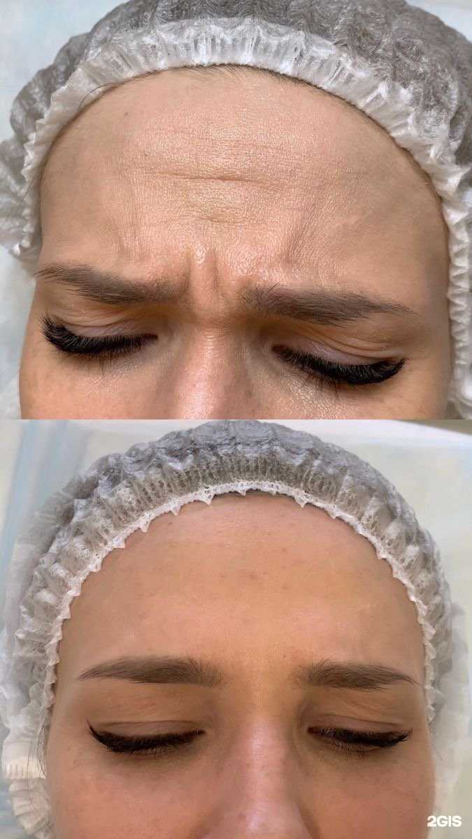 Отзывы на компанию Кабинет косметолога Марины Волосновой в Хабаровске c фото