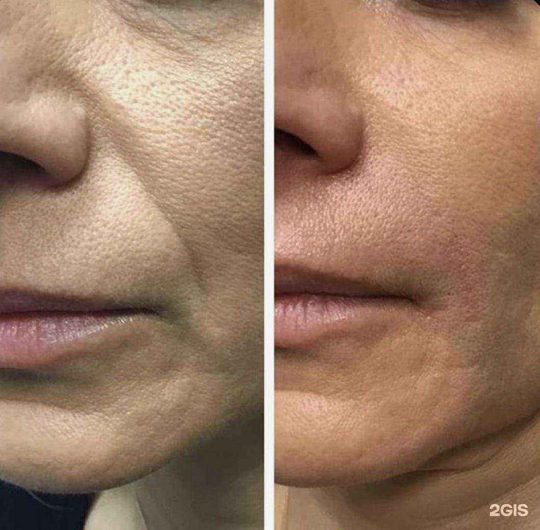 Отзывы на компанию Силуэт в г. Анапа c фото