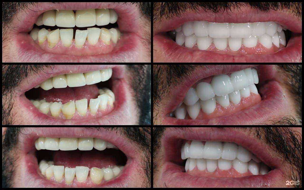 Отзывы на компанию New dent в Барнауле c фото