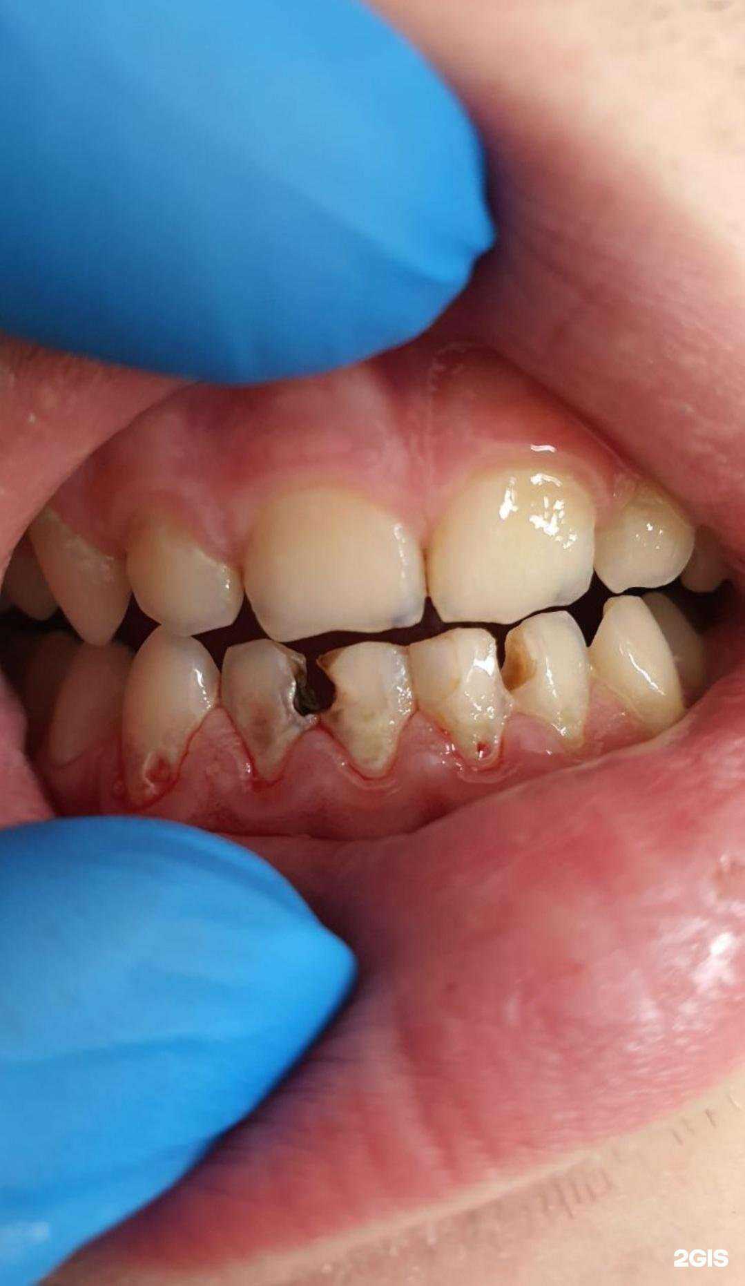 Отзывы на компанию Ru.Dent в Сочи c фото