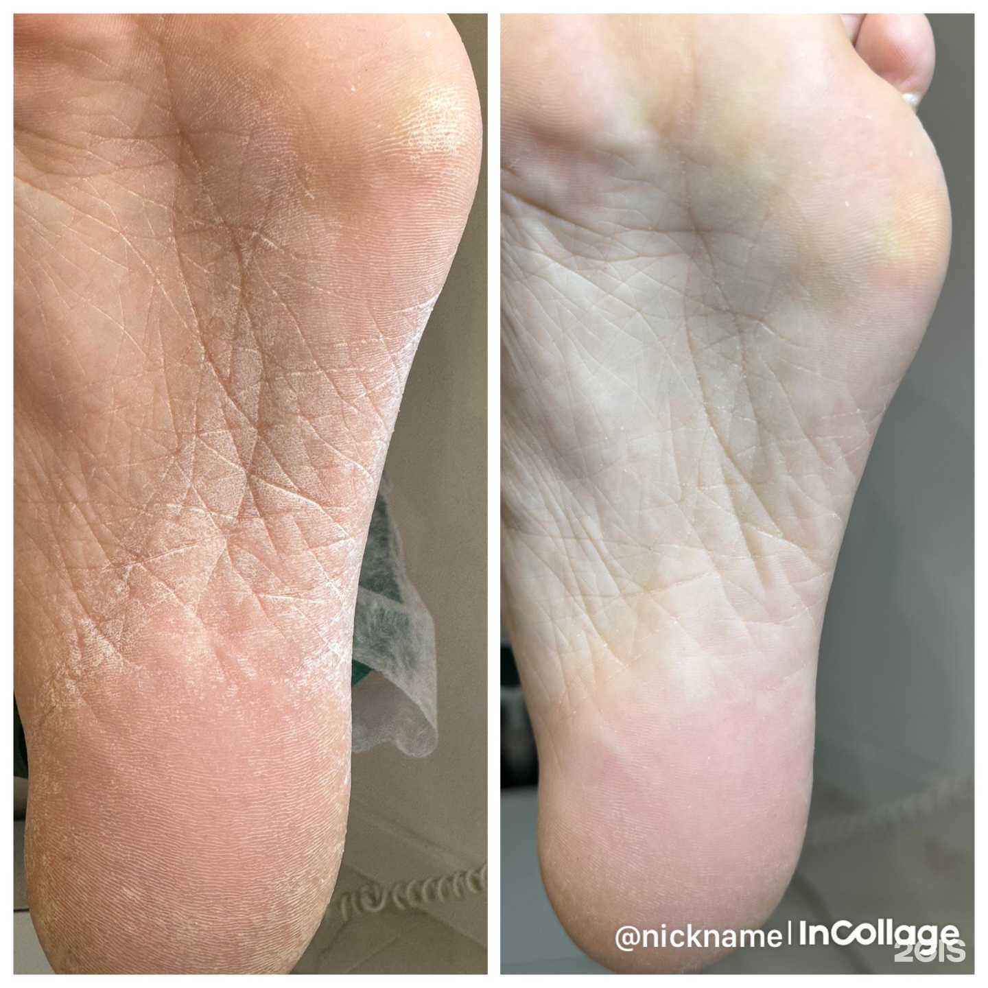 Отзывы на компанию Кабинет педикюра и маникюра в Екатеринбурге c фото