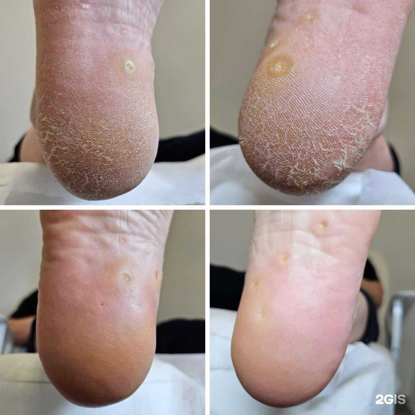 Отзывы на компанию Центр здоровой стопы в Тюмени c фото