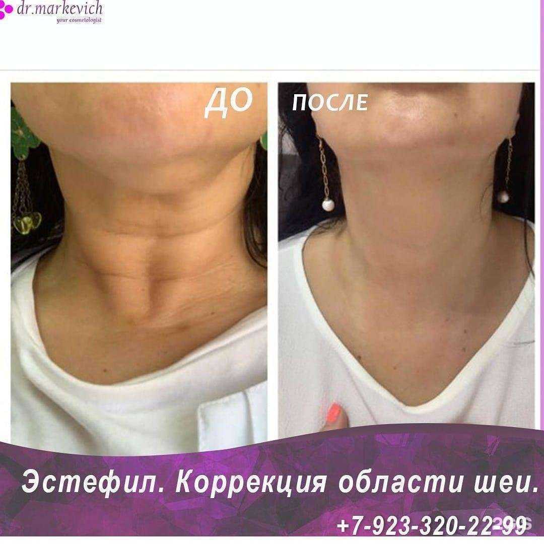 Отзывы на компанию Возрождение в г. Томск c фото