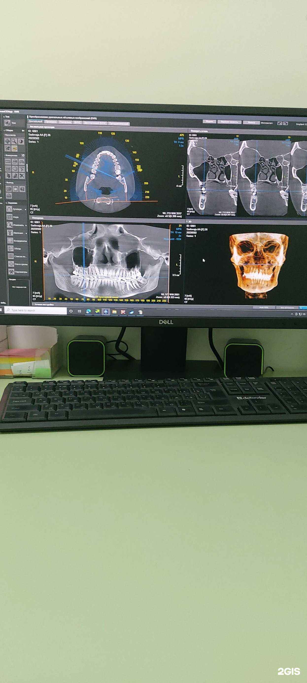 Отзывы на компанию 3D рентген в г. Барнаул c фото