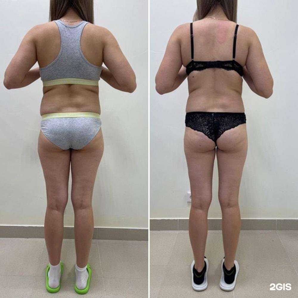 Отзывы на компанию Male в г. Йошкар-Ола c фото