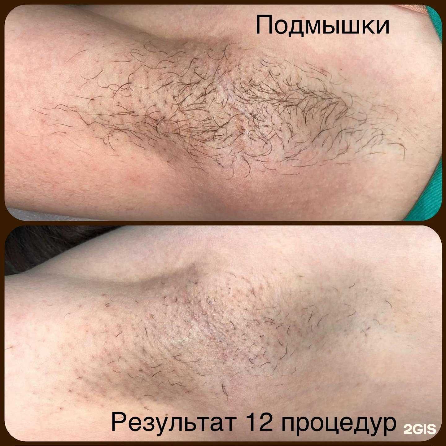 Отзывы на компанию Студия эпиляции в г. Ульяновск c фото