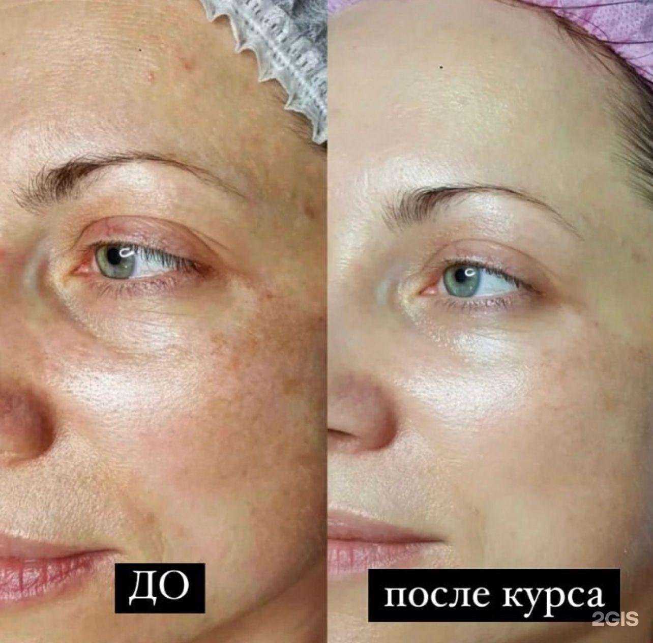 Отзывы на компанию Студия холодной плазмы в Иркутске c фото