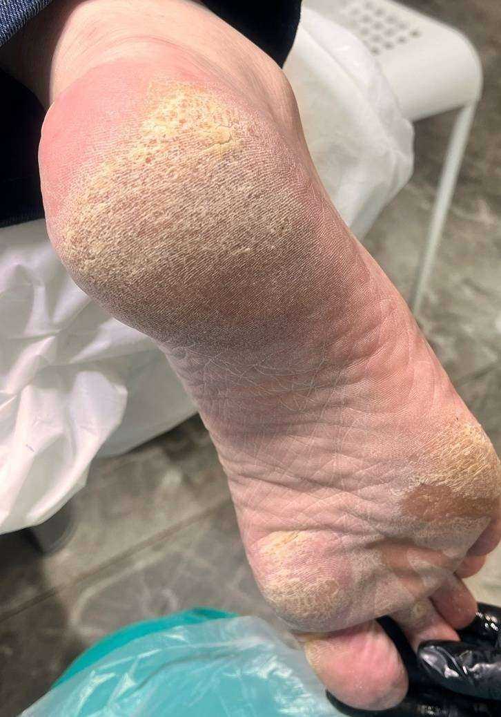 Отзывы на компанию Академия здоровых стоп и ногтей by Novikova  в Архангельске c фото