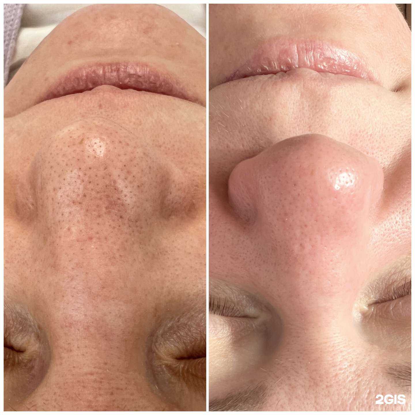 Отзывы на компанию Proepil в Миассе c фото