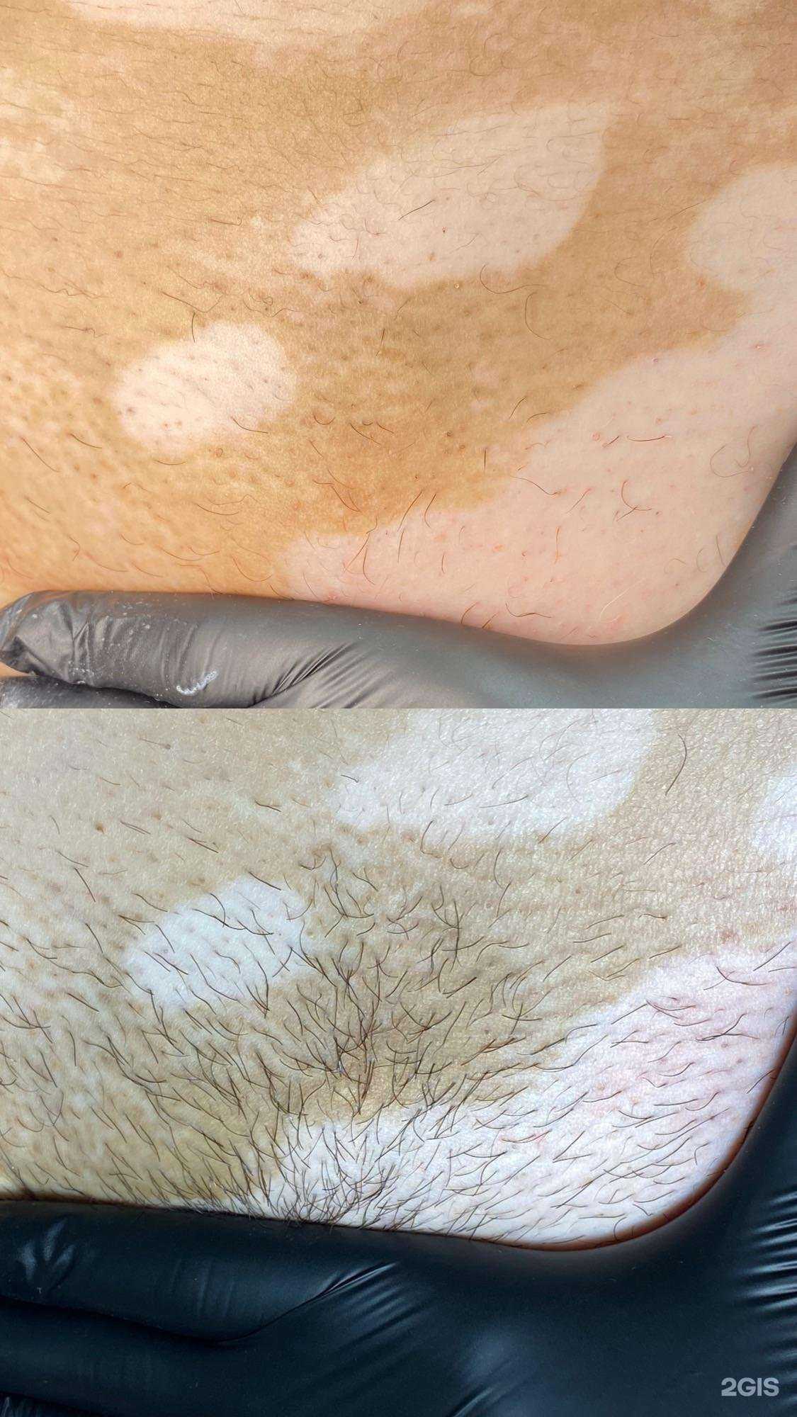 Отзывы на компанию Салон электроэпиляции и лазерной эпиляции  в г. Саратов c фото