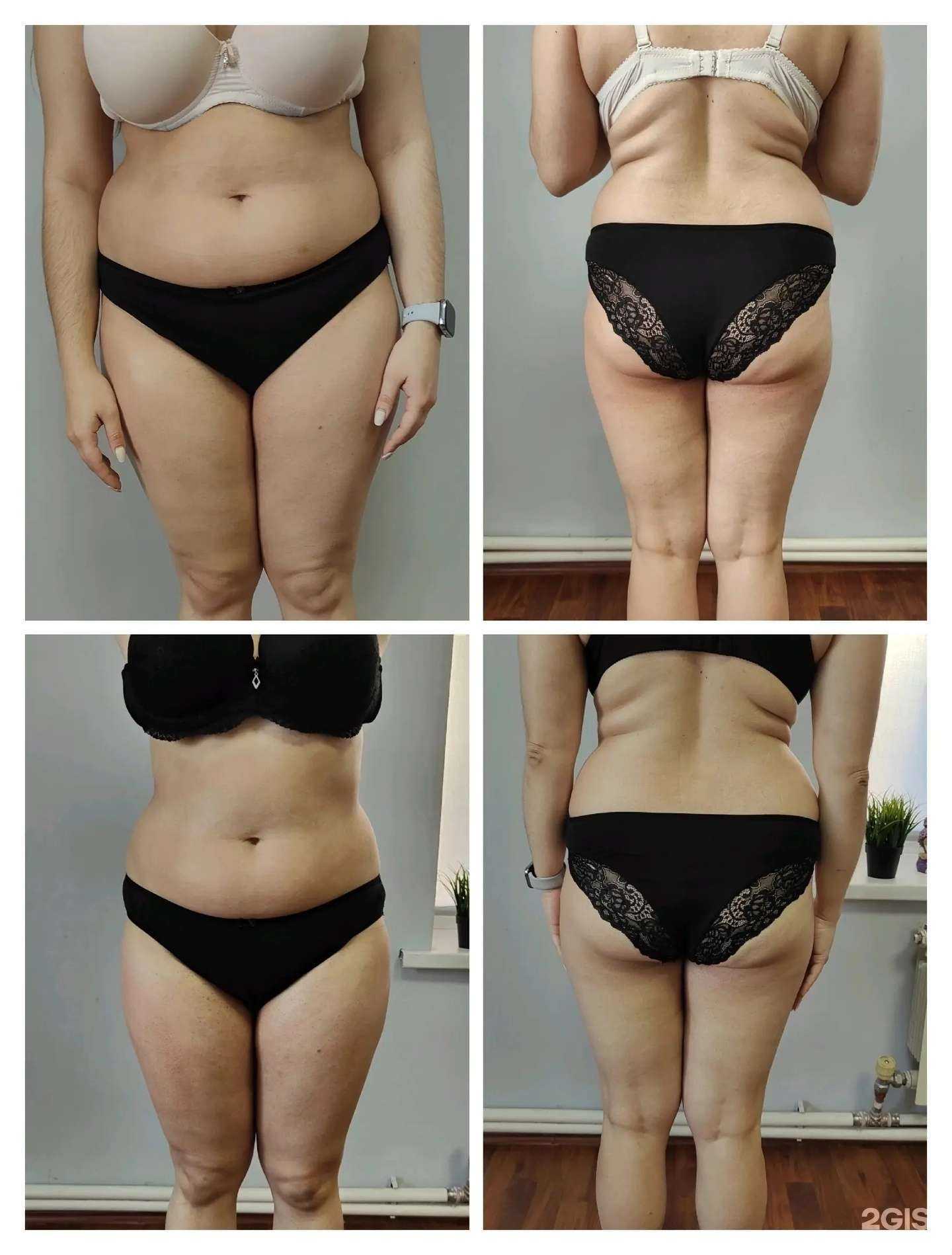 Отзывы на компанию Бьюти-студия депиляции и коррекции фигуры Натальи Савченко в Барнауле c фото