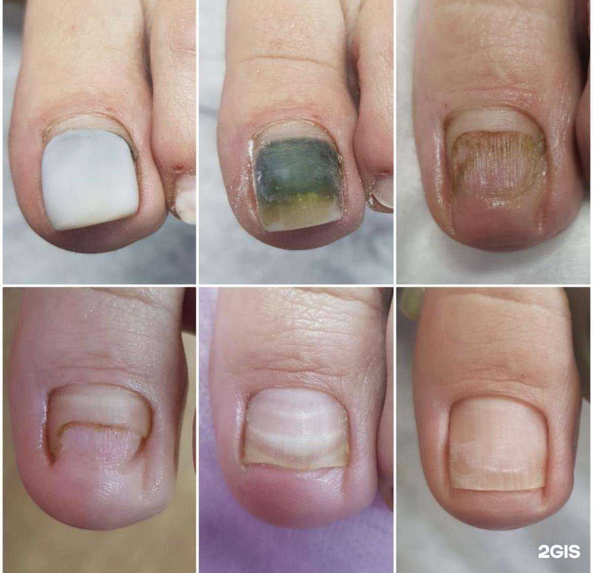 Отзывы на компанию Здоровая стопа в г. Геленджик c фото