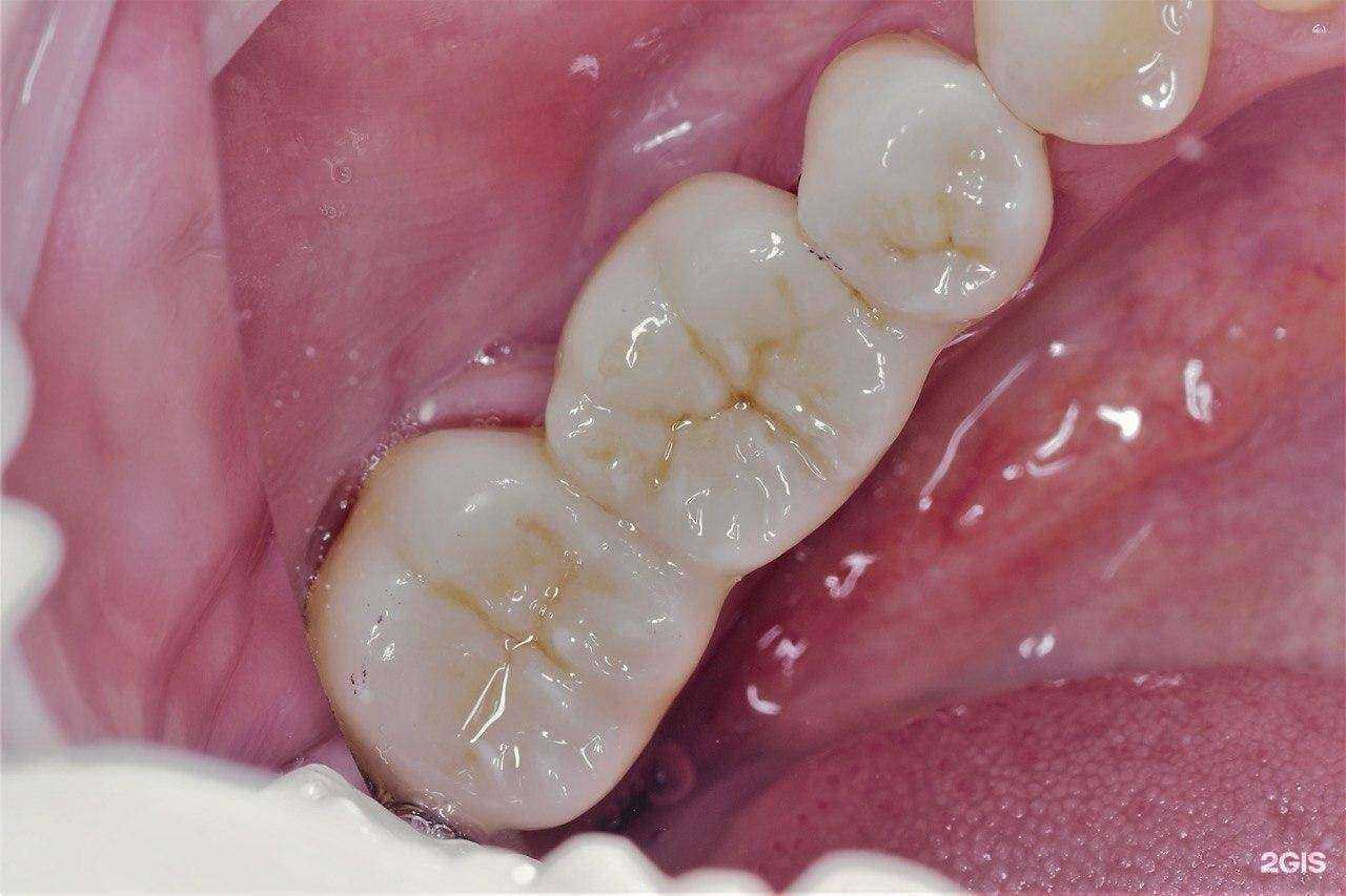Отзывы на компанию МегаДэнтПлюс в Казани c фото