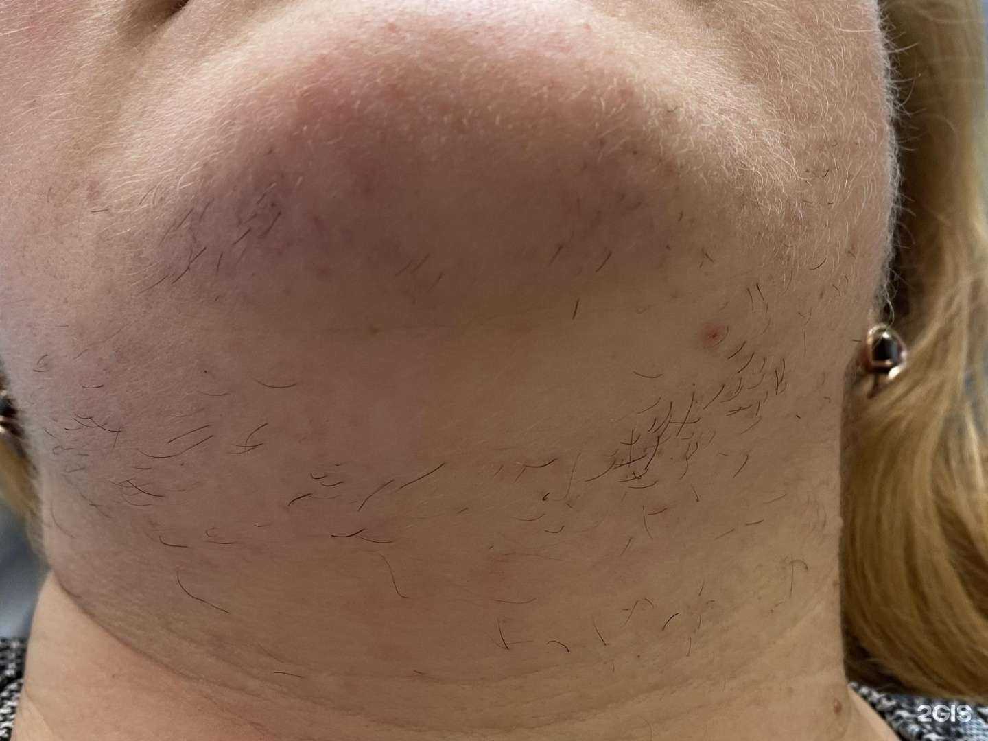 Отзывы на компанию Epiler в Новосибирске c фото