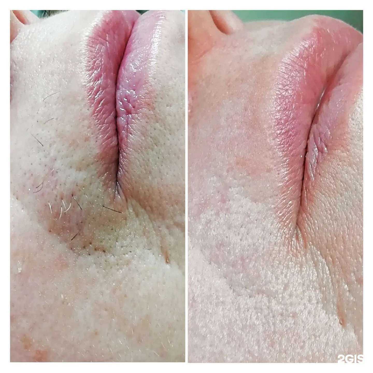 Отзывы на компанию Студия эпиляции для мужчин и женщин в г. Томск c фото